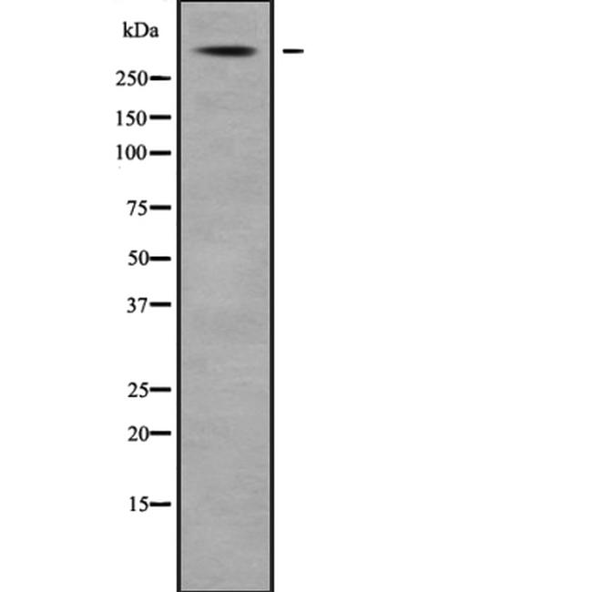 USP24 Antibody in Western Blot (WB)