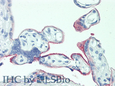 5T4 Antibody in Immunohistochemistry (Paraffin) (IHC (P))