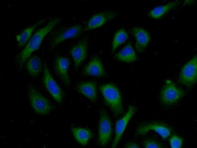AKAP11 Antibody in Immunocytochemistry (ICC/IF)