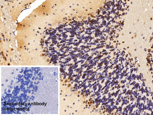 ANP32A Antibody in Immunohistochemistry (Paraffin) (IHC (P))