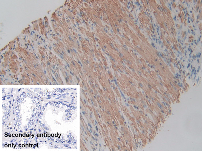ACTG2 Antibody in Immunohistochemistry (Paraffin) (IHC (P))