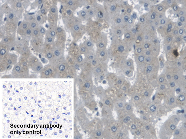 ARPC4 Antibody in Immunohistochemistry (Paraffin) (IHC (P))