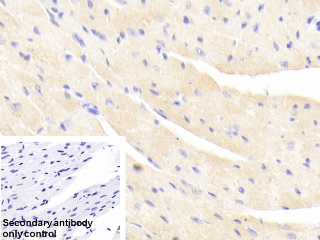 alpha Actinin 2 Antibody in Immunohistochemistry (Paraffin) (IHC (P))