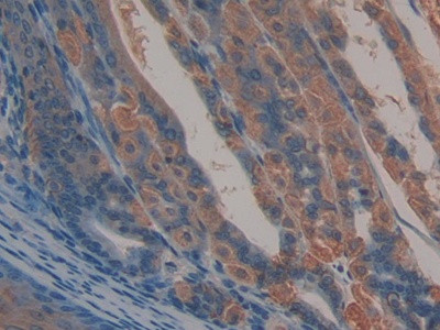 CD166 (ALCAM) Antibody in Immunohistochemistry (Paraffin) (IHC (P))