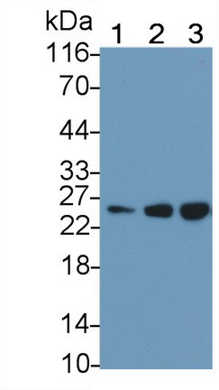 AK3 Antibody in Western Blot (WB)