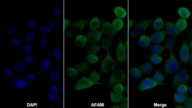 ADRM1 Antibody in Immunocytochemistry (ICC/IF)