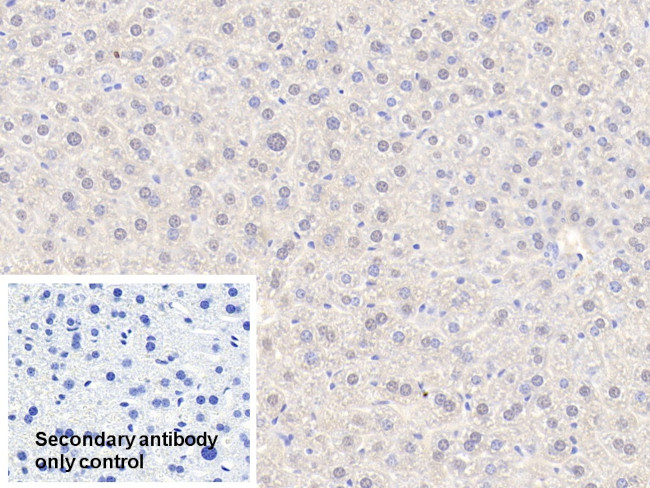 Alcohol Dehydrogenase 1A Antibody in Immunohistochemistry (Paraffin) (IHC (P))