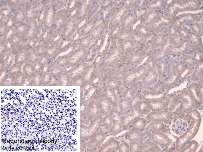 alpha Adducin Antibody in Immunohistochemistry (Paraffin) (IHC (P))