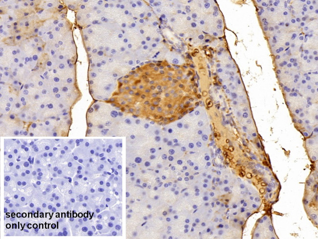 alpha-1 Antitrypsin Antibody in Immunohistochemistry (Paraffin) (IHC (P))