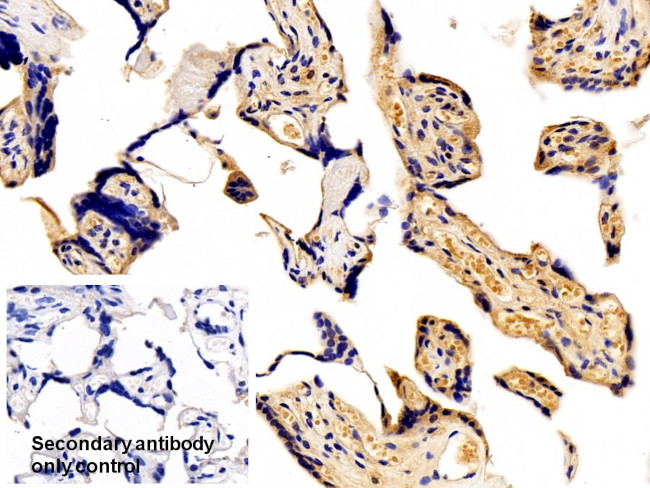 AFP Antibody in Immunohistochemistry (Paraffin) (IHC (P))