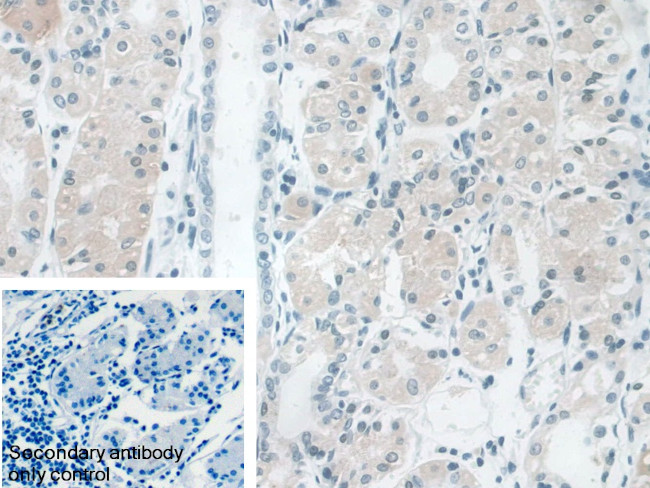 AUP1 Antibody in Immunohistochemistry (Paraffin) (IHC (P))