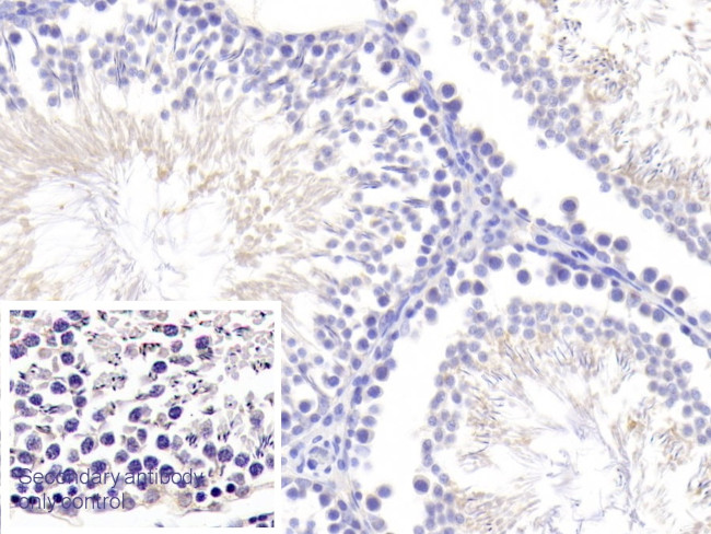 Angiogenin Antibody in Immunohistochemistry (Paraffin) (IHC (P))