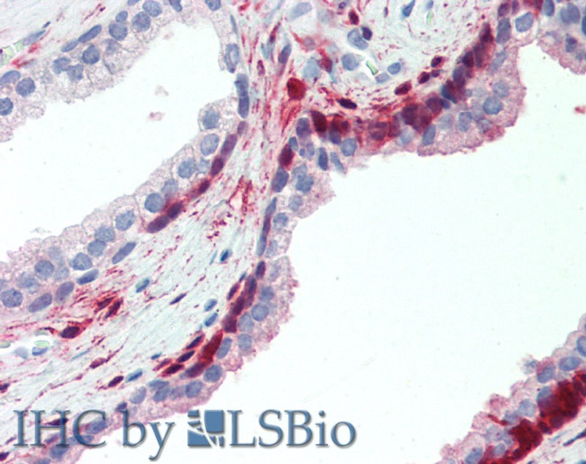 ANTXR2 Antibody in Immunohistochemistry (Paraffin) (IHC (P))
