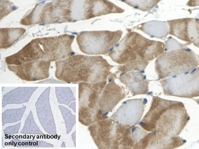 APOB Antibody in Immunohistochemistry (Paraffin) (IHC (P))