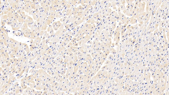 ABCB8 Antibody in Immunohistochemistry (Paraffin) (IHC (P))