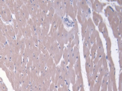 MRP6 Antibody in Immunohistochemistry (Paraffin) (IHC (P))