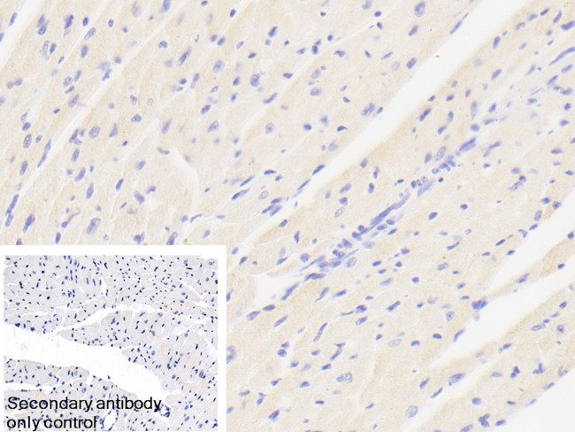 ABCD2 Antibody in Immunohistochemistry (Paraffin) (IHC (P))