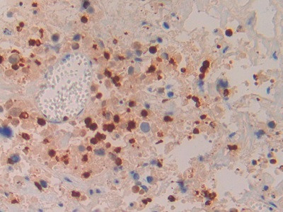 Azurocidin Antibody in Immunohistochemistry (Paraffin) (IHC (P))