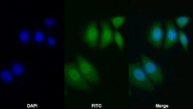 Bcl-2 Antibody in Immunocytochemistry (ICC/IF)
