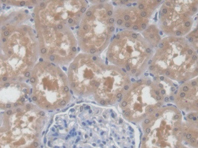 UPB1 Antibody in Immunohistochemistry (Paraffin) (IHC (P))