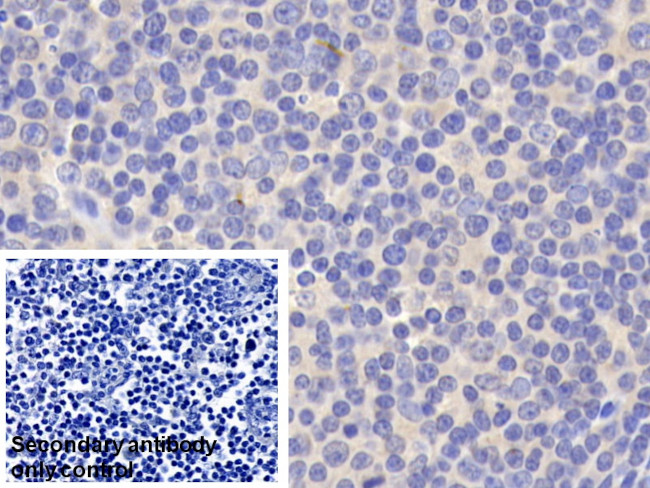 BID Antibody in Immunohistochemistry (Paraffin) (IHC (P))