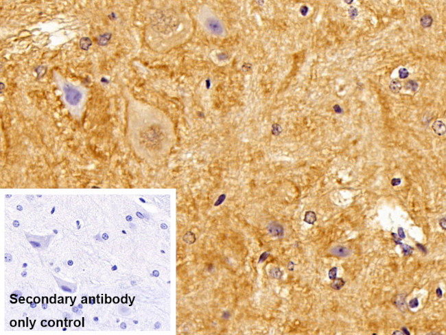 Brevican Antibody in Immunohistochemistry (Paraffin) (IHC (P))