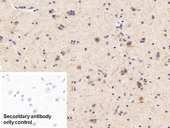 CAMLG Antibody in Immunohistochemistry (Paraffin) (IHC (P))
