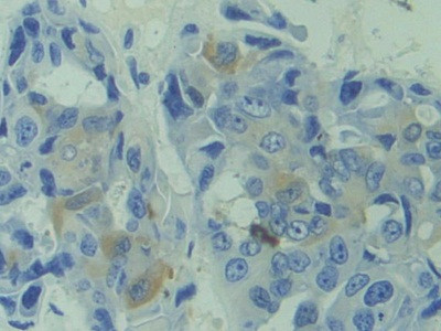 CAPS Antibody in Immunohistochemistry (Paraffin) (IHC (P))