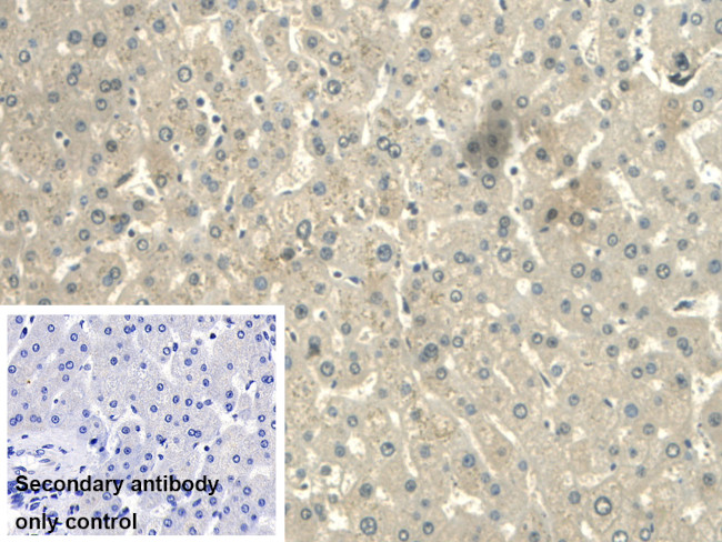 CALML3 Antibody in Immunohistochemistry (Paraffin) (IHC (P))
