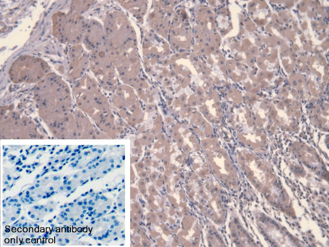 Calpain 9 Antibody in Immunohistochemistry (Paraffin) (IHC (P))