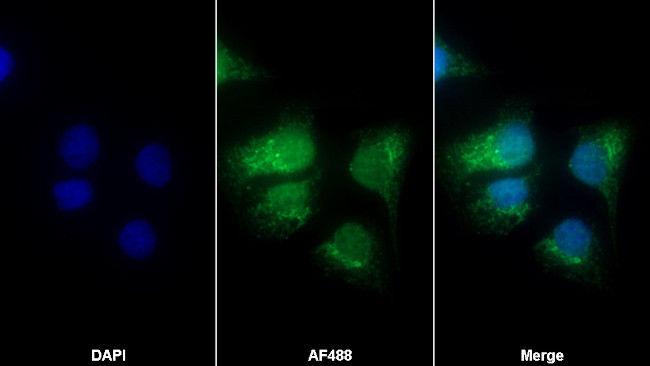 Calumenin Antibody in Immunocytochemistry (ICC/IF)