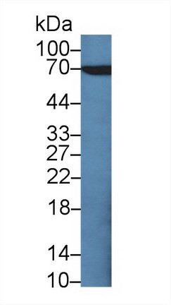 CD66e (CEA) Antibody in Western Blot (WB)