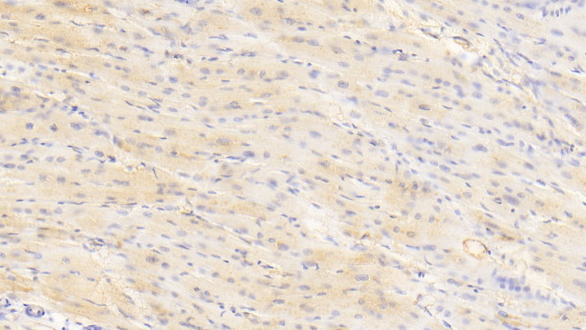 CSN3 (CASK) Antibody in Immunohistochemistry (Paraffin) (IHC (P))