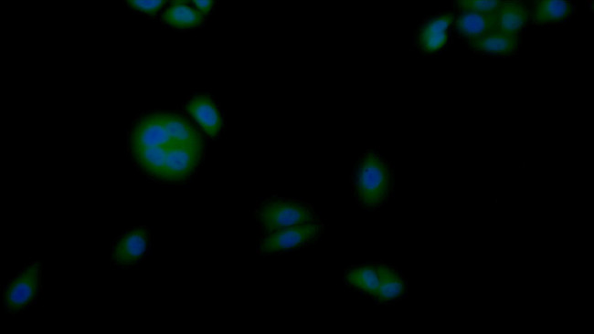 CK1 alpha Antibody in Immunocytochemistry (ICC/IF)