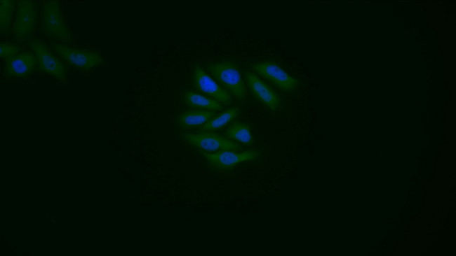 Caspase 1 Antibody in Immunocytochemistry (ICC/IF)