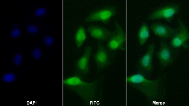 Caspase 2 Antibody in Immunocytochemistry (ICC/IF)