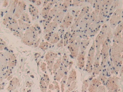 Caspase 3 Antibody in Immunohistochemistry (Paraffin) (IHC (P))