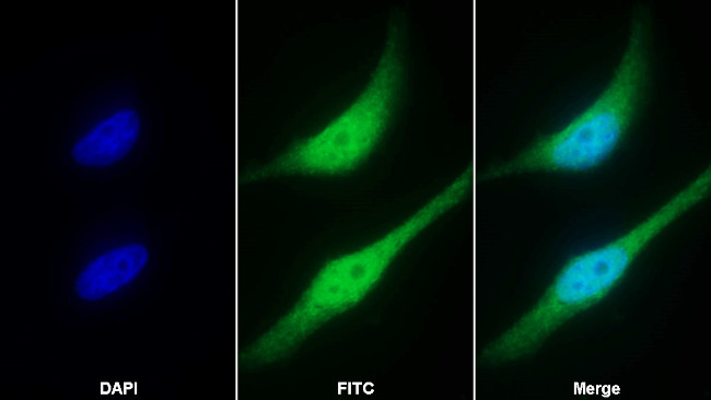 Caspase 8 Antibody in Immunocytochemistry (ICC/IF)