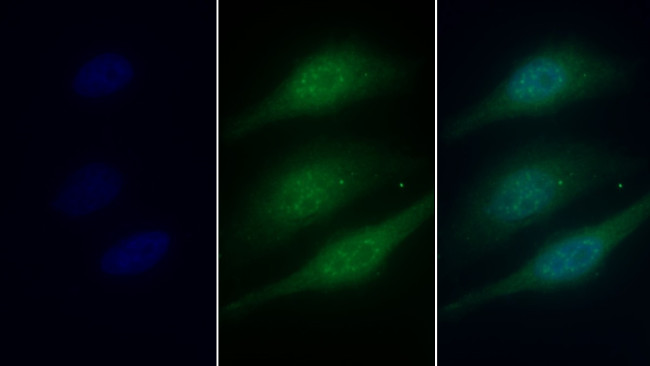 Catalase Antibody in Immunocytochemistry (ICC/IF)