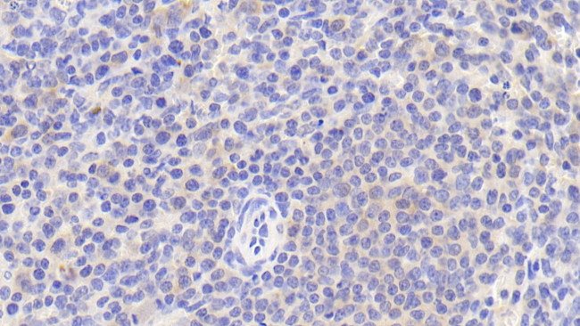 CD5 Antibody in Immunohistochemistry (Paraffin) (IHC (P))