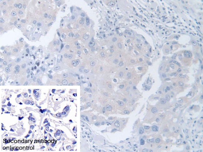 TCP-1 beta Antibody in Immunohistochemistry (Paraffin) (IHC (P))