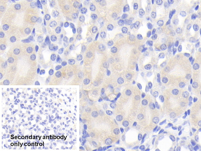 Chemerin Antibody in Immunohistochemistry (Paraffin) (IHC (P))