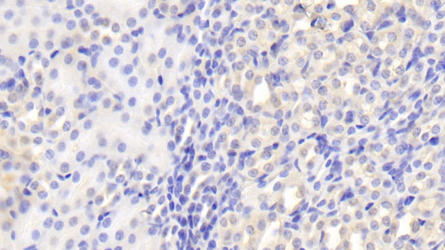 CLTA Antibody in Immunohistochemistry (Paraffin) (IHC (P))