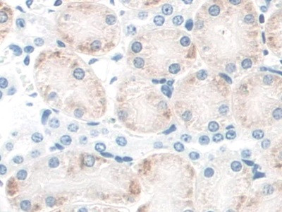 CD164 Antibody in Immunohistochemistry (Paraffin) (IHC (P))