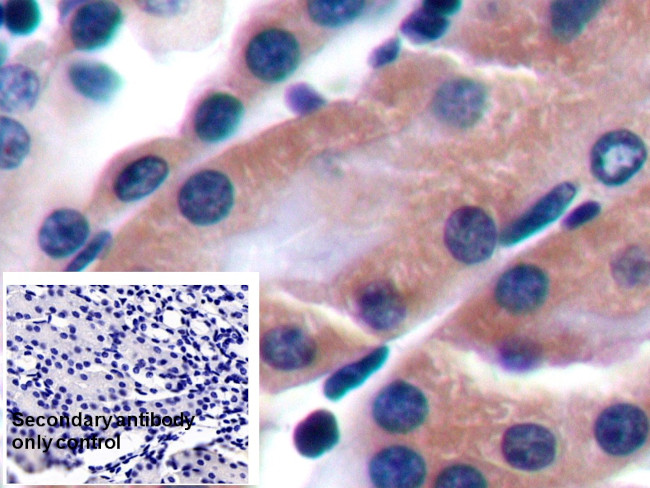 CD229 Antibody in Immunohistochemistry (Paraffin) (IHC (P))
