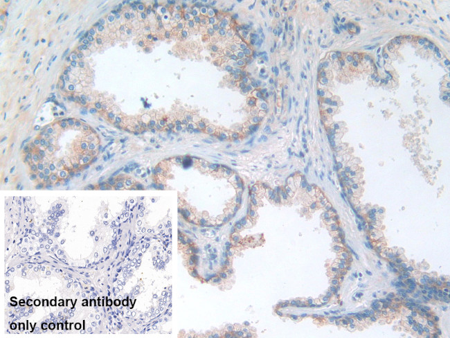 B7-H3 Antibody in Immunohistochemistry (Paraffin) (IHC (P))