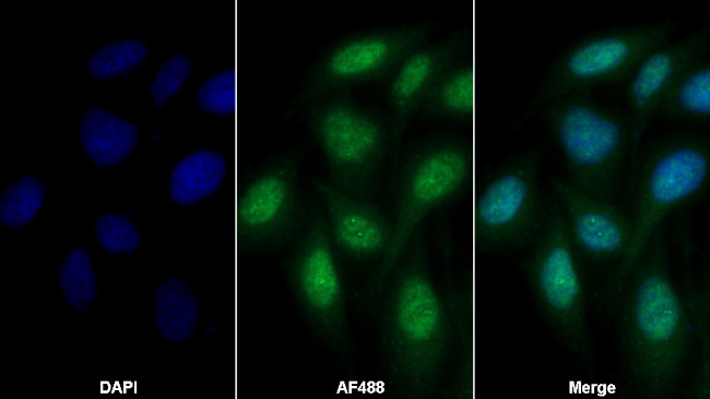 Factor V Antibody in Immunocytochemistry (ICC/IF)