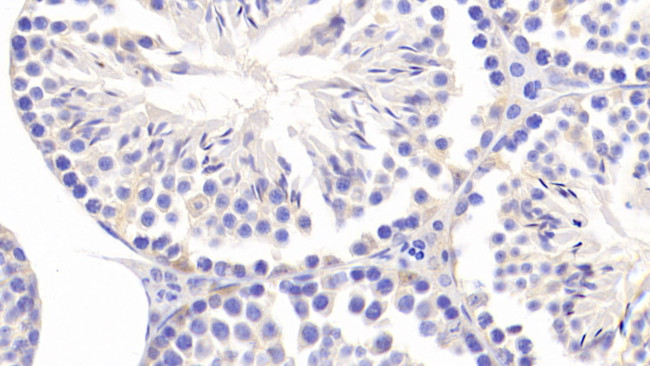 CCDC60 Antibody in Immunohistochemistry (Paraffin) (IHC (P))