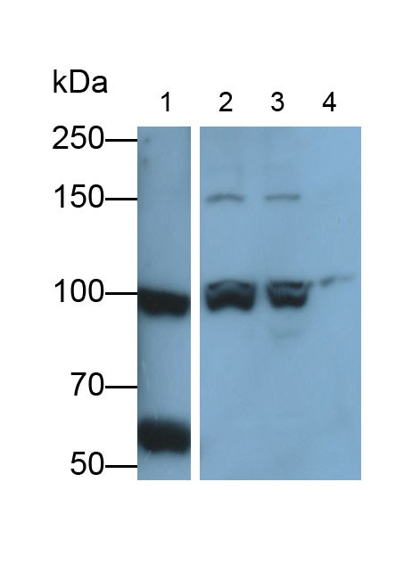 Collagen III Antibody in Western Blot (WB)