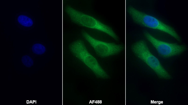 COL4A4 Antibody in Immunocytochemistry (ICC/IF)